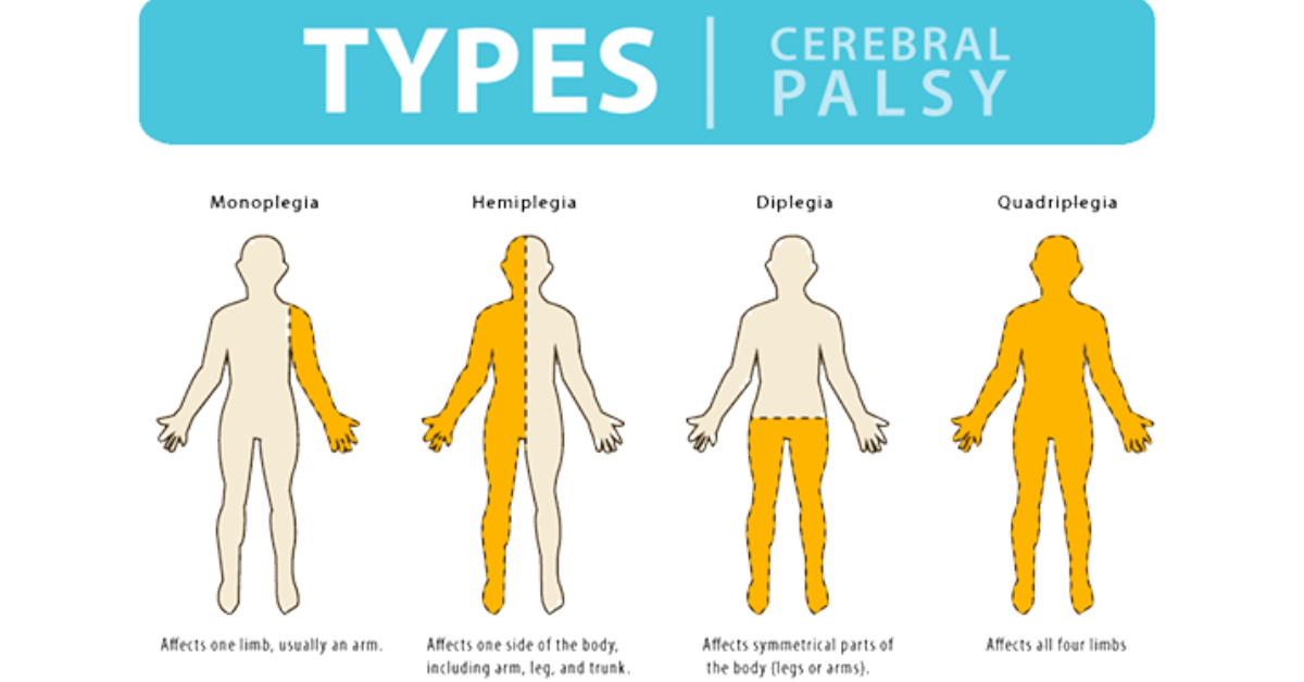 Stem Cell Treatment in India: A Comprehensive Overview